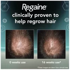 Regaine Men's Extra Strength Hair Loss And Hair Regrowth Scalp Foam Treatment 73ml 12 Regaine Men's Extra Strength Hair Loss And Hair Regrowth Scalp Foam Treatment 73ml -No Hair care products shop, no kiss. 11433830 1124931414539314