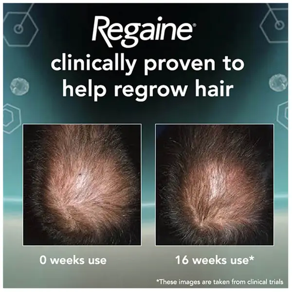 Regaine Men's Extra Strength Hair Loss And Hair Regrowth Scalp Foam Treatment 73ml 7 Regaine Men's Extra Strength Hair Loss And Hair Regrowth Scalp Foam Treatment 73ml - Image 5