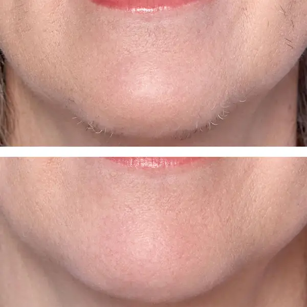 Hollywood Smoother Rose Gold - Exclusive 8 Hollywood Smoother Rose Gold - Exclusive - Image 6