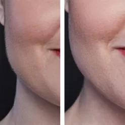 Hollywood Smoother Rose Gold - Exclusive 11 Hollywood Smoother Rose Gold - Exclusive -No Hair care products shop, no kiss. 12458471 1274900819000659