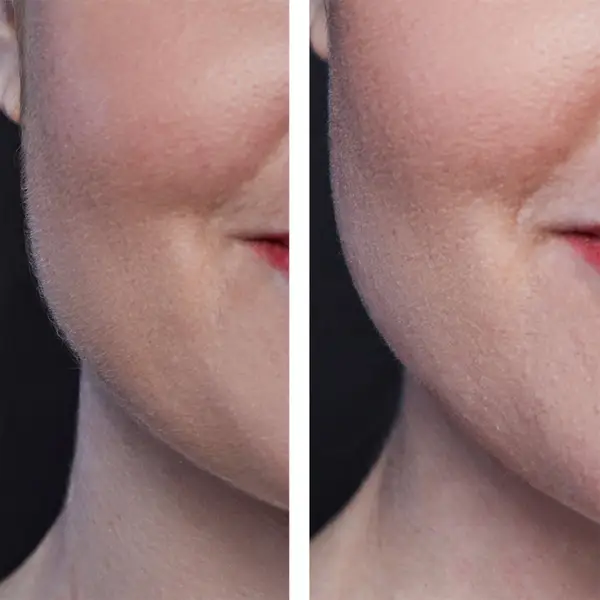 Hollywood Smoother Rose Gold - Exclusive 6 Hollywood Smoother Rose Gold - Exclusive - Image 4