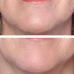 Hollywood Smoother Replacement Heads -No Hair care products shop, no kiss. 12458473 9584900820243283