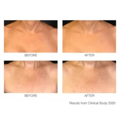 Rio DécoLITE Beauty Boosting Light Treatment -No Hair care products shop, no kiss. 12866753 1604838662968474