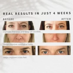 Sensse Professional LED Face Mask 13 Sensse Professional LED Face Mask -No Hair care products shop, no kiss. 13521558 6864936828481025