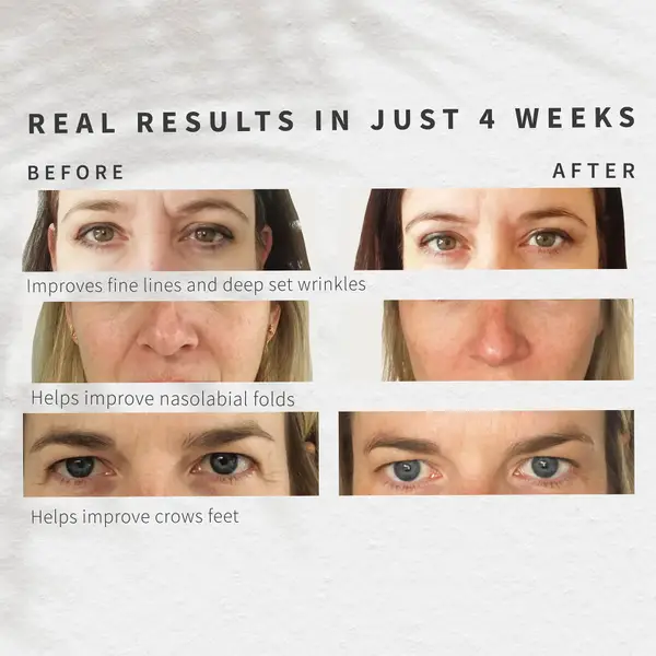 Sensse Professional LED Face Mask 8 Sensse Professional LED Face Mask - Image 6