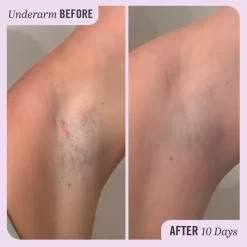 First Aid Beauty Ingrown Hair Treatment Pads (28 Pads) 13 First Aid Beauty Ingrown Hair Treatment Pads (28 Pads) -No Hair care products shop, no kiss. 13522060 8124926203747460